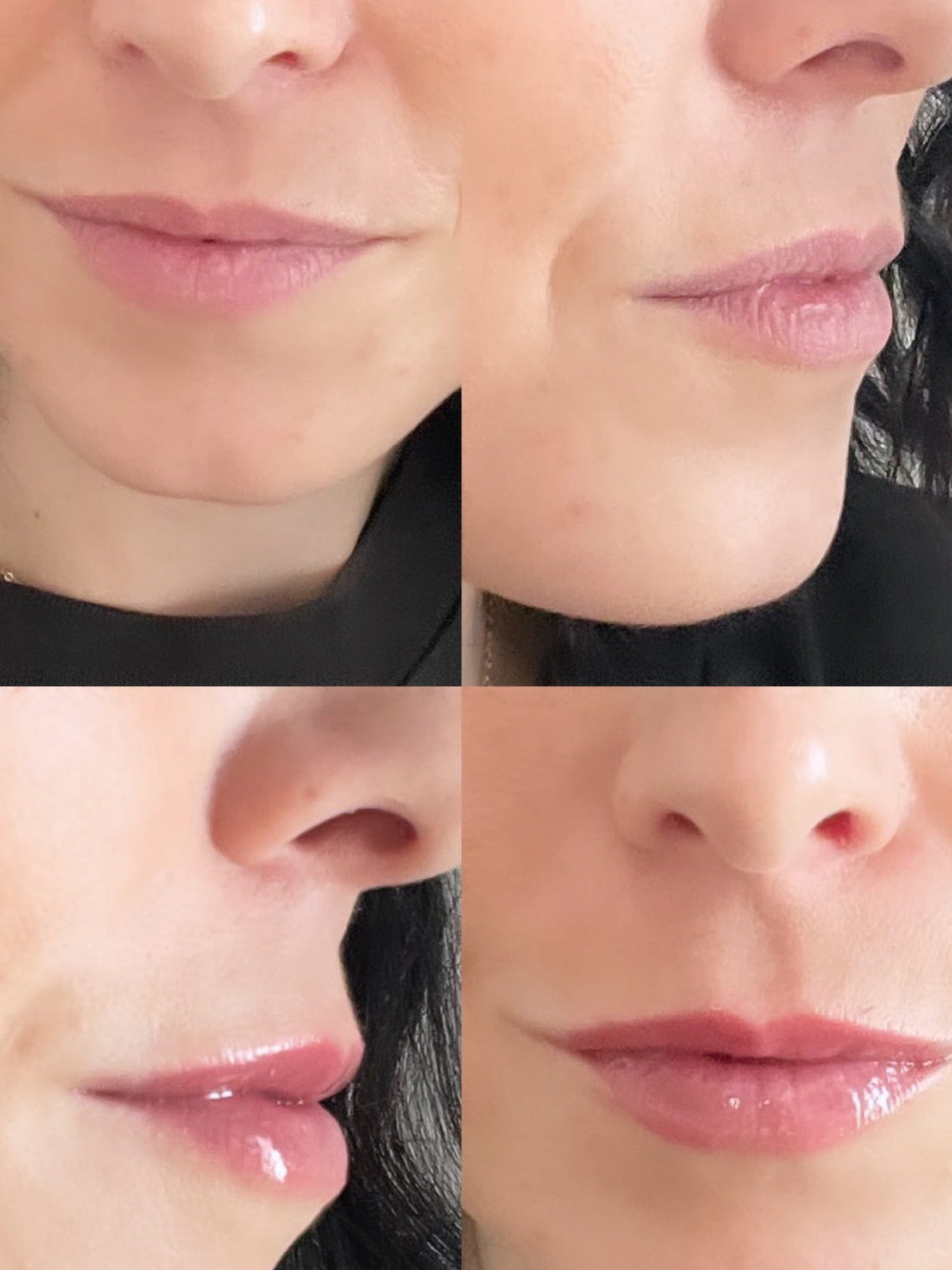 Before and after collage of lips using Bellamarque lip oil